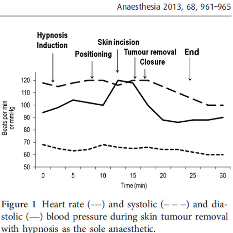 Parametri emodinamici durante l'operazione sotto ipnosi Parametri emodinamici durante l'operazione sotto ipnosi