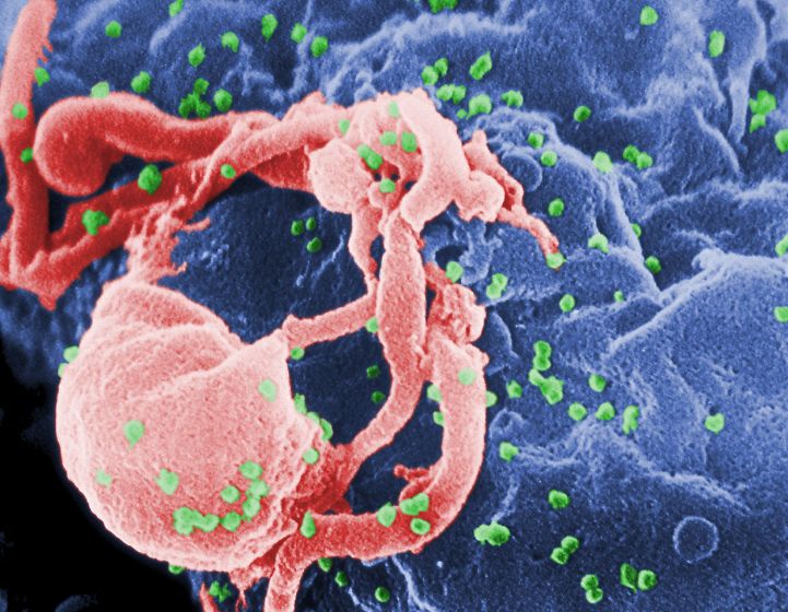 hiv